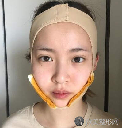 高占巍磨骨对比图
