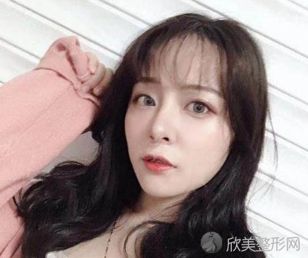 成都西区医院邓东伟做鼻子怎么样_术后案例_价格表