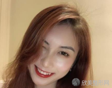 成都八大处是三甲吗-正规吗-收费价目表-双眼皮案例