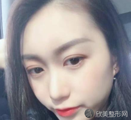 成都八大处是三甲吗-正规吗-收费价目表-双眼皮案例