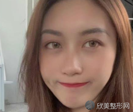 成都八大处是三甲吗-正规吗-收费价目表-双眼皮案例