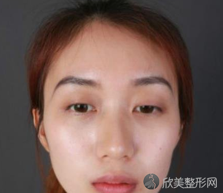 成都八大处是三甲吗-正规吗-收费价目表-双眼皮案例