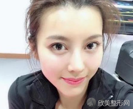 成都友谊医院李萍隆鼻怎么样-真实案例反馈--较近价格表