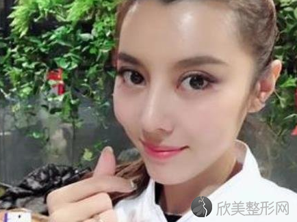 成都友谊医院李萍隆鼻怎么样-真实案例反馈--较近价格表