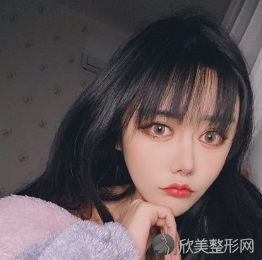 北京协和医院整形科兔唇修复靠谱吗-案例-收费标准