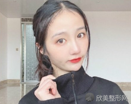 北京八大处刘敦隆鼻怎么样-术后案例-全新价格表