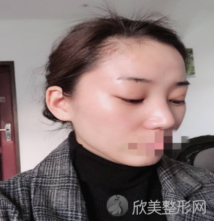 上海哪个医生做眼修复较好-柴云怎么样-附2021价格表