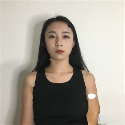 成都军建医院整形美容中心怎么样？医院案例-项目价格表较新