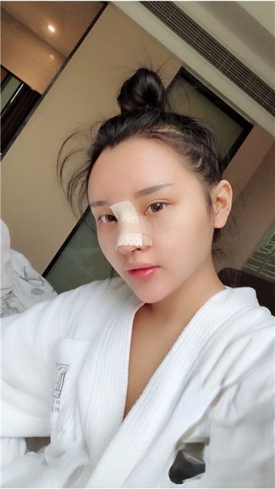 重庆美仑美奂整形美容怎么样？附案例-价格表一览