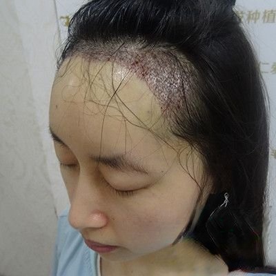 长沙鹏爱医疗美容医院是正规医院吗？医院案例-项目价格表较新