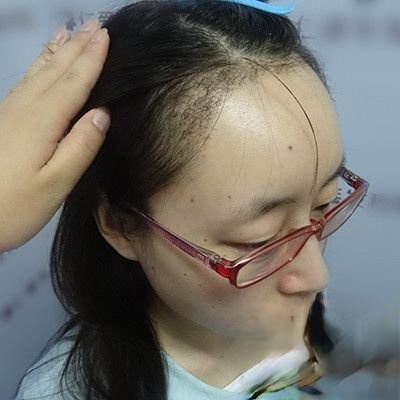 长沙鹏爱医疗美容医院是正规医院吗？医院案例-项目价格表较新