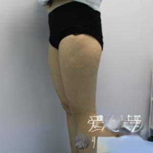 长沙鹏爱医疗整形医院怎么样？附案例-全新价格表