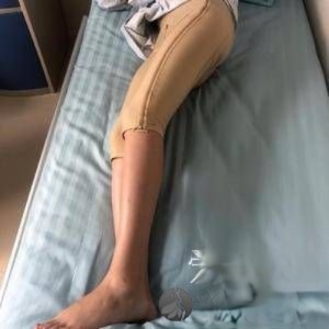 长沙鹏爱医疗整形医院怎么样？附案例-全新价格表