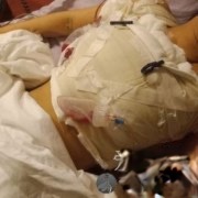 长沙恩喜医疗美容医院怎么样?附案例-全新价格表