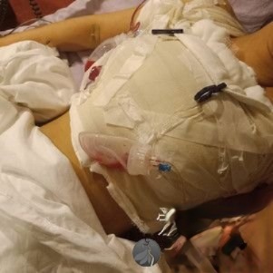 长沙恩喜医疗美容医院怎么样?附案例-全新价格表