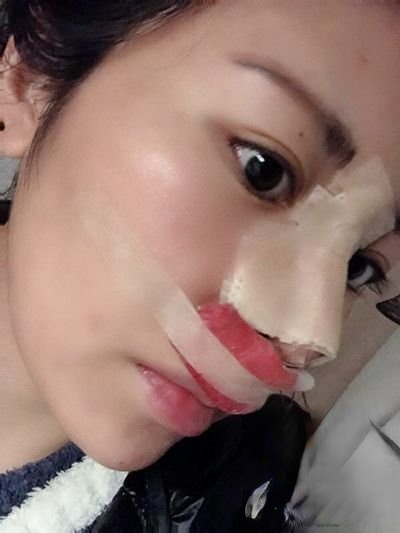 长沙雅美医疗美容医院是正规医院吗？附案例-全新价格表