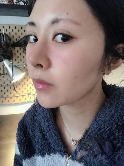 长沙雅美医疗美容医院是正规医院吗？附案例-全新价格表