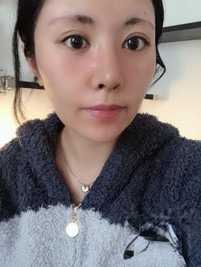 长沙雅美医疗美容医院是正规医院吗？附案例-全新价格表