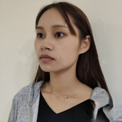 武汉美亚医院靠谱吗？附案例-全新价格表