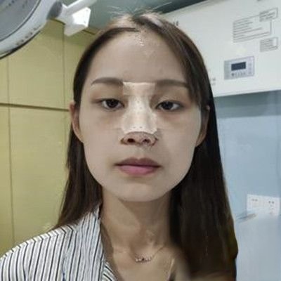 武汉美亚医院靠谱吗？附案例-全新价格表