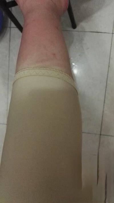 天津华中医疗整形医院怎么样？医院案例-项目价格表较新