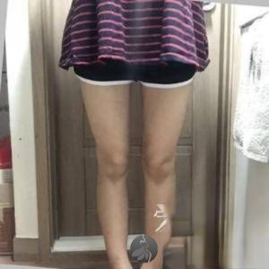 天津华中医疗整形医院是正规的么？附案例-全新价格表