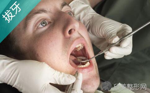 拔牙有哪些禁忌，能引起什么危害？