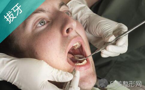 拔牙有哪些护理牙齿方法？