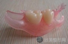 拔牙之后镶什么牙好？