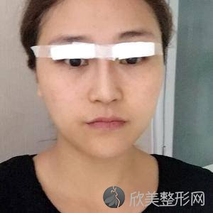 八大处北京八大处王连召手术怎么样?地址-价格在线查询