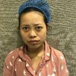 八大处蔡磊做狐臭手术怎样?案例反馈-收费标准