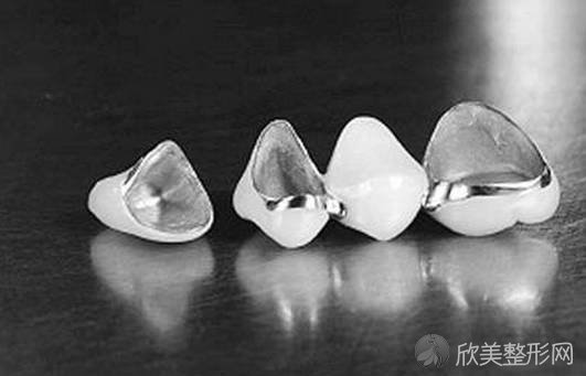 为什么说“补牙不做冠，疗效少一半”，牙冠到底有多重要？