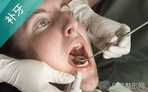 蛀牙的补牙过程和步骤是什么？