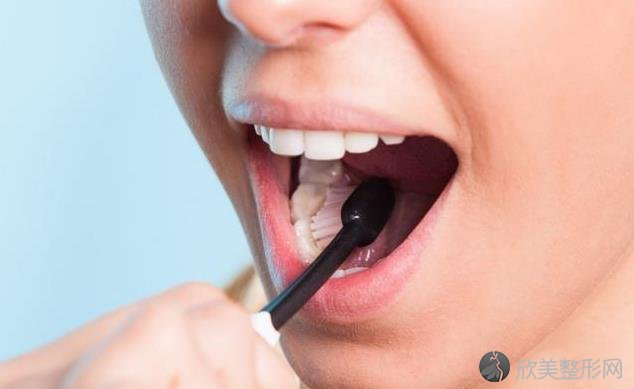 洗牙会让牙齿越来越脆？这4个误区，让大家不敢去洗牙！