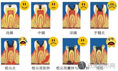 牙嵌体和补牙、牙冠有什么区别？
