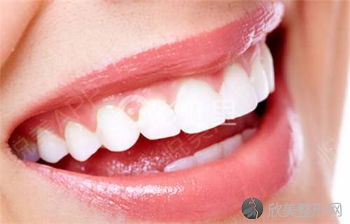 洗牙可有效预防牙周病？