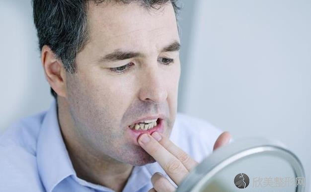 口腔粘膜病常见有4类，其中一种，几乎每人都得过！别说你不知道！