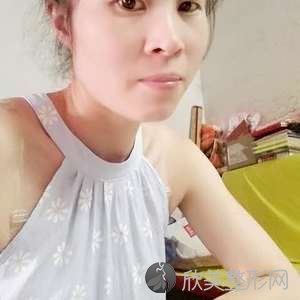 八大处杨晓楠眼综合价格?**附案例及价格表