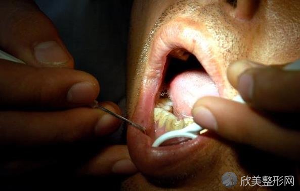 别小瞧口腔疾病，不好好治，可能诱发这4种重大疾病！