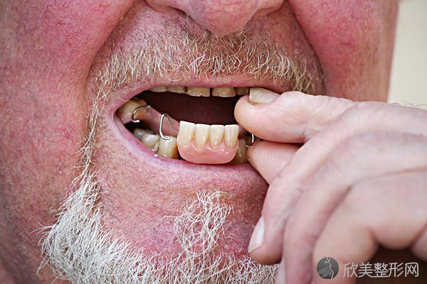长期戴活动假牙会有什么危害？