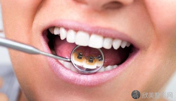 牙周病不能拖！牙齿出现5个状况，好好检查一下口腔！