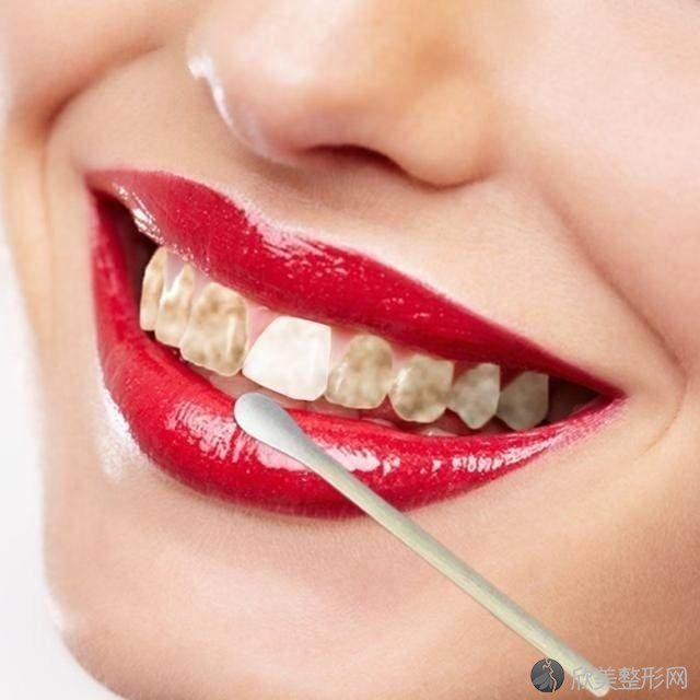 早晚刷牙还是牙黄有口臭？教你几招，让你牙齿变白口腔无异味！