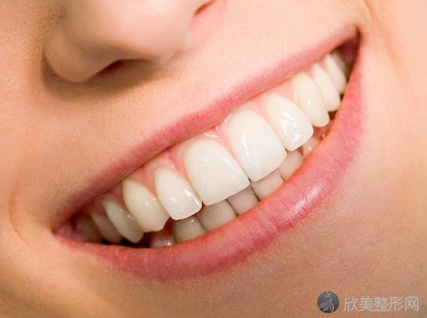 既简单又快捷的牙齿美白修复技术一牙齿贴面修复！