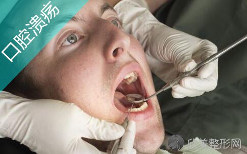 口腔溃疡的鉴别诊断方法是什么，如何预防口腔溃疡？