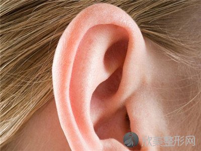 耳廓畸形图片，耳廓畸形能治疗吗？