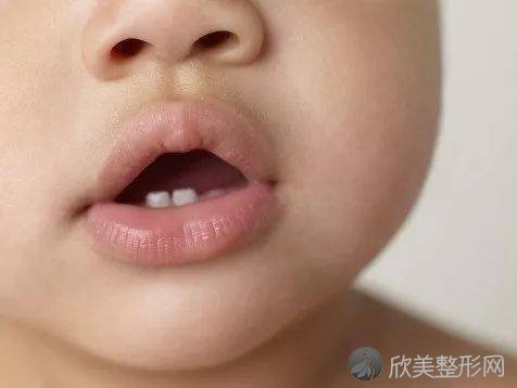 儿童换牙期间，爸爸妈妈们要注意些什么?