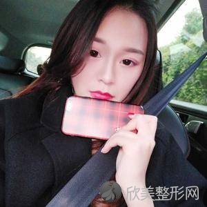 八大处整形外科医院钱瑾怎么样?埋线提升附上医生案例及价格表一览