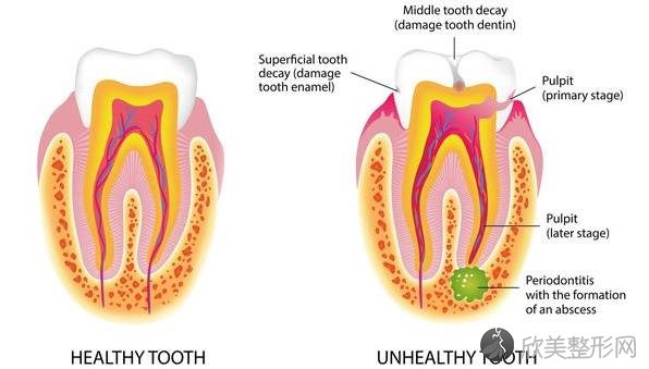 这4个口腔疾病，可能是牙痛的根源所在，及时发现很重要！