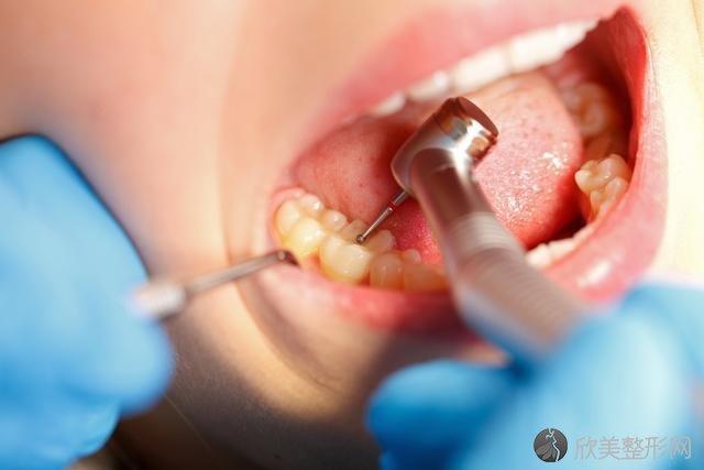什么是根管治疗？用针探入牙齿不会疼吗？做根管之前你要知道这些！