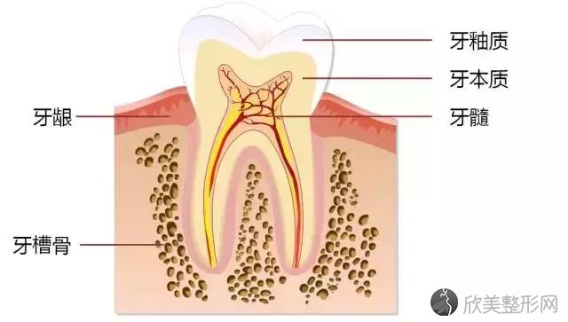 龋齿（蛀牙）是牙齿生虫吗？得了龋齿怎么办？